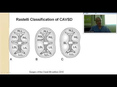 AV canal surgical management by Dr Suresh Rao (Old)