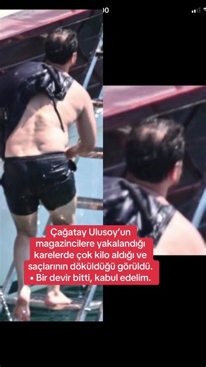 Çağatay Ulusoy son hali: kilo ve saç değişimi haberleri açıklandı