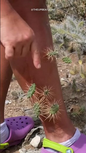 Why Cactus Spines Are So Hard to Remove 🌵 (EXPLAINED)
