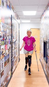 Look at her incredible progress! Coleman traveled all the way from West Virginia to receive her first set of prosthetic legs as a new bilateral below-knee amputee. ✨She spent a week at our facility, starting on Day 1 with casting and taking her first steps in a diagnostic socket. By Day 2, she received her final prosthesis. The rest of the week was dedicated to gait training!🦾🦿 #prosthesis #amputee #prostheticlegs #belowkneeamputee | A Step Ahead Prosthetics