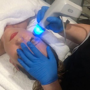 218 reactions · 36 shares | This patient received treatment to her under eyes from our new Exilis skin tightening technology! Contact us to book you're Free consultation #medspa #technology #phoenix #tighten #exilis | Derma Health Skin & Laser | Facebook