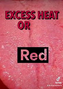 3.8K views · 288 reactions |  Basic Tongue Diagnosis in TCM: Tongue...