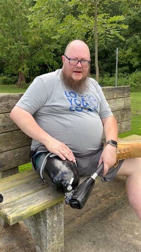 57K views · 1.1K reactions | Patrick Gorman sharing his above knee...