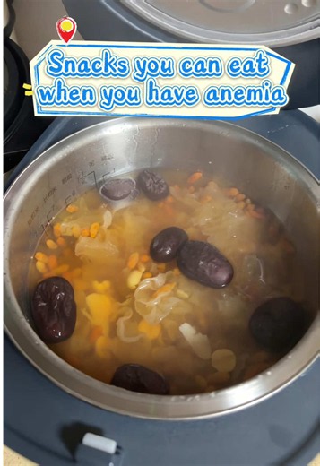 Anemia-Friendly Snacks to Boost Iron and Energy