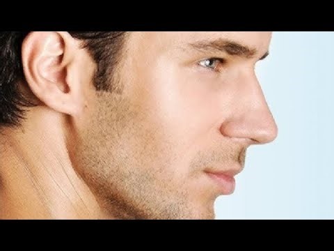 HOW TO GET RID OF CHUBBY CHEEKS YOU MUST TRY THIS