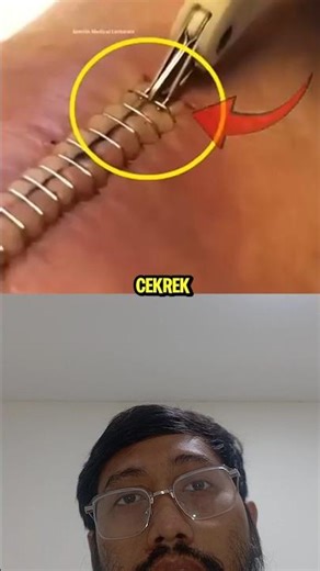 WOUND STAPLER ⁉️ why does it look like PAPER 😰 #healthfacts #uniquefacts #drbimo