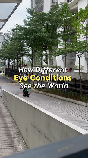 Understanding Eye Conditions: Glaucoma, Cataracts, and More
