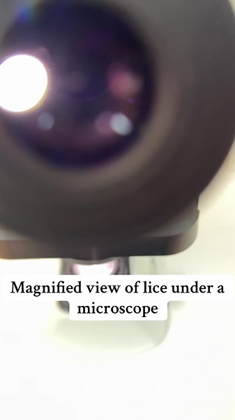 Discover Lice Under a Microscope: A Detailed View
