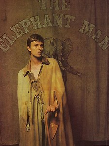 ‘The Elephant Man’: David Bowie on Broadway, 1980