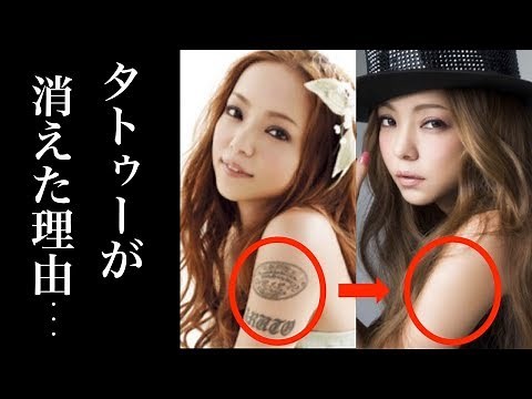安室奈美恵の左腕のタトゥーが消えた”ある理由”に涙が止まらない…隠された母親としての思いとは…