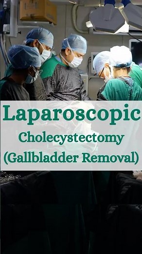 Laparoscopic Cholecystectomy (Gallbladder Removal)