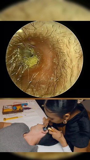 dirty skin cleaning no TikTok