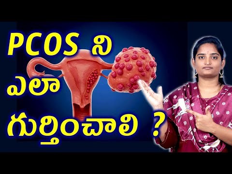 How to Diagnose PCOS? | Polycystic Ovary Syndrome Signs, Causes & Complete Homeopathy Medicine Cure