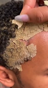 5.4M views · 4K reactions | ASMR REMOVAL FLAKES AND PSORIASIS WITH LONG FINGER NAIL (45) | Showerer | Facebook