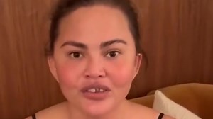 Chrissy Teigen suffers medical emergency during Christmas crafts disaster