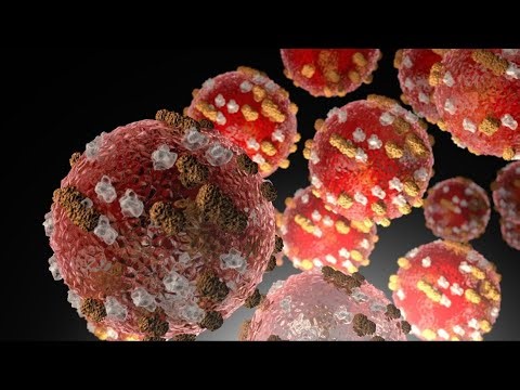 Washtenaw County confirms 7th measles case -- What to know