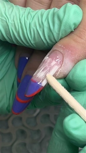 Drastically broken nail😑 #nailrepair #nailtips #nailtutorial #brokennail #gel #nailtips