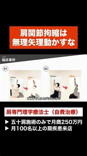 【肩関節可動域制限】無理に動かさない⁉︎肩専門理学療法士が解説！