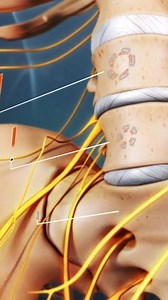 What sciatica symptoms do you have? 👇 | Spine-health