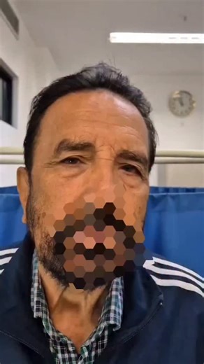 MEDWIZARDS on Instagram: "Involuntary twitching of face. Hemifacial spasm##newpost #medstudent #shorts #neuroscience #neet"