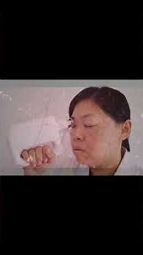 Ultrasound Stimulation for Optic Nerve Reparation