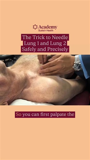 Why depth and direction matter more than force When working around LU-1, the goal isn’t the muscle It’s the nerve innervating the muscle The process starts with palpation Finding the septum, the insertion site, and recognising the natural groove created by the deltoid–pectoral plane All needling stays within this plane No lateral movement toward the deltoid or humerus No medial movement toward the lung field Just precise depth and direction The intention is simple but specific Insert from the se