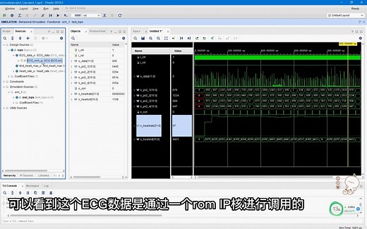 基于FPGA的ECG心电信号峰值检测和心率计算,包括testbench测试文件和ECG数据转换为coe文件程序