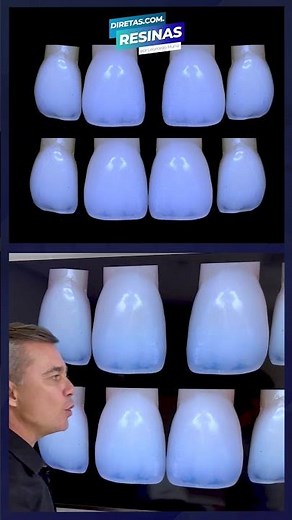 Fechamento de Diastema com Resina Composta