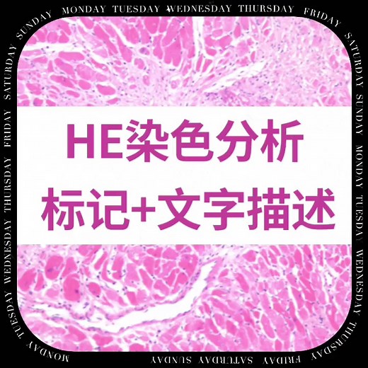 染色分析/病理分析/He染色分析