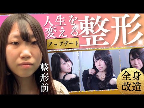 【全身整形】人生を変える別人級フル整形【美容外科】 Plastic Surgery Tokyo Japan