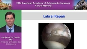 Hip Arthroscopy