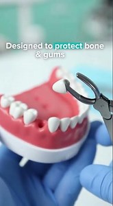 🦷 What Instruments Are Used During a Tooth Extraction?