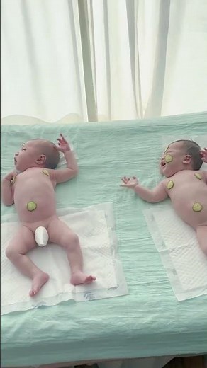 Newborn poop explosion! The funniest face ever, even siblings can't help but laugh 🥺 #baby #人类幼崽