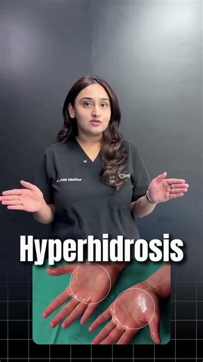 Hyperhidrosis | Botox For Sweating | Sweaty Palms | Sweaty Feet | Botox Treatment