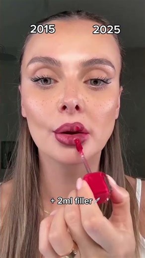 💉 2015 vs 2025 | 2ml Lip Filler Transformation Through the Years #shorts #makeup