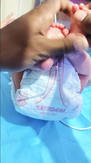 How to Put Pampers on a Crying New Born Baby 🤩 | Step by Step Diaper Wearing Guide 🍼💖 | So Cuteness🚼