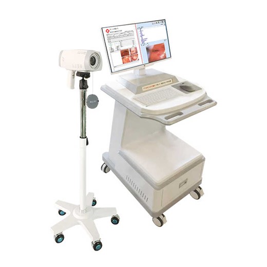 Women Gynecological Examination Vagina Video Electronic Colposcopy Camera Colposcope for Gynecology