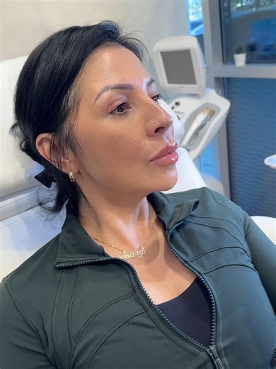 Achieving Full and Natural Lips: Tips and Techniques