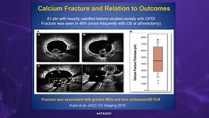 Assessment and Treatment of Calcified Coronary Artery Lesions: How to Use IVUS and OCT? When to Perform Cutting/Scoring Balloon Angioplasty, Rotational and Laser Angioplasty?