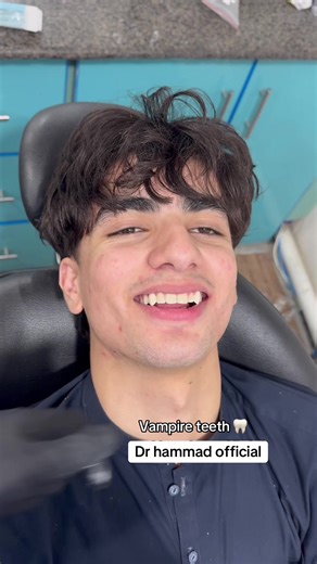 Vampire Teeth Transformation in Dentistry