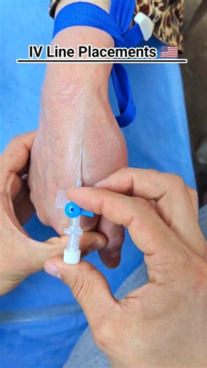 IV Cannulation Technique #nurse #usnurse #hospital #trending #medicosstuff #anatomy #doctor