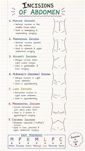 Abdominal Incisions for Exams | Easy Notes