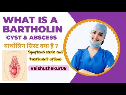 “Private Area Swelling?”“Bartholin Cyst or Abscess?” – Symptoms, Causes, Treatment & Prevention