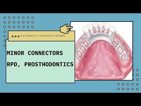 Minor Connectors | Removable Partial Denture | Prosthodontics