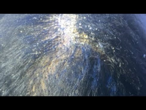 ASMR | Scalp Scratching & Lice Check