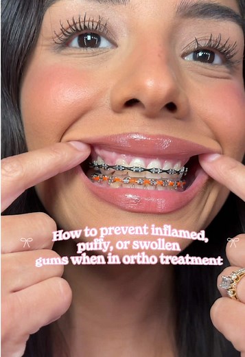 Braces Tips for Maintaining Oral Hygiene