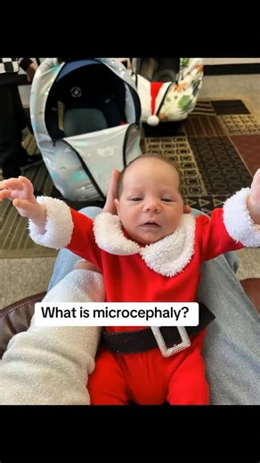 Cassey | What is microcephaly? ⬇️⬇️⬇️ Microcephaly is a medical condition where a baby’s head is smaller than expected for their age and sex... | Instagram