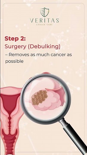 Interval Debulking Surgery in Ovarian Cancer | Treatment Approach Explained! #ovariancancer #veritas