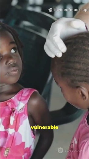 Mpox Emergency Downgraded? Africa’s Fight Isn’t Over!