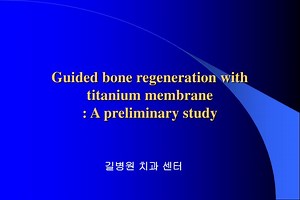 Guided bone regeneration with titanium membrane : A preliminary study - SlideServe
